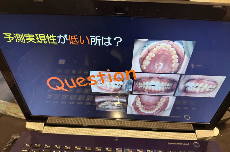 第1回 矯正症例検討会01