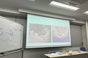 第2回 インプラントアドバンス01