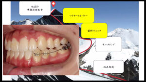 2026.04.23 第1回 矯正症例検討会01